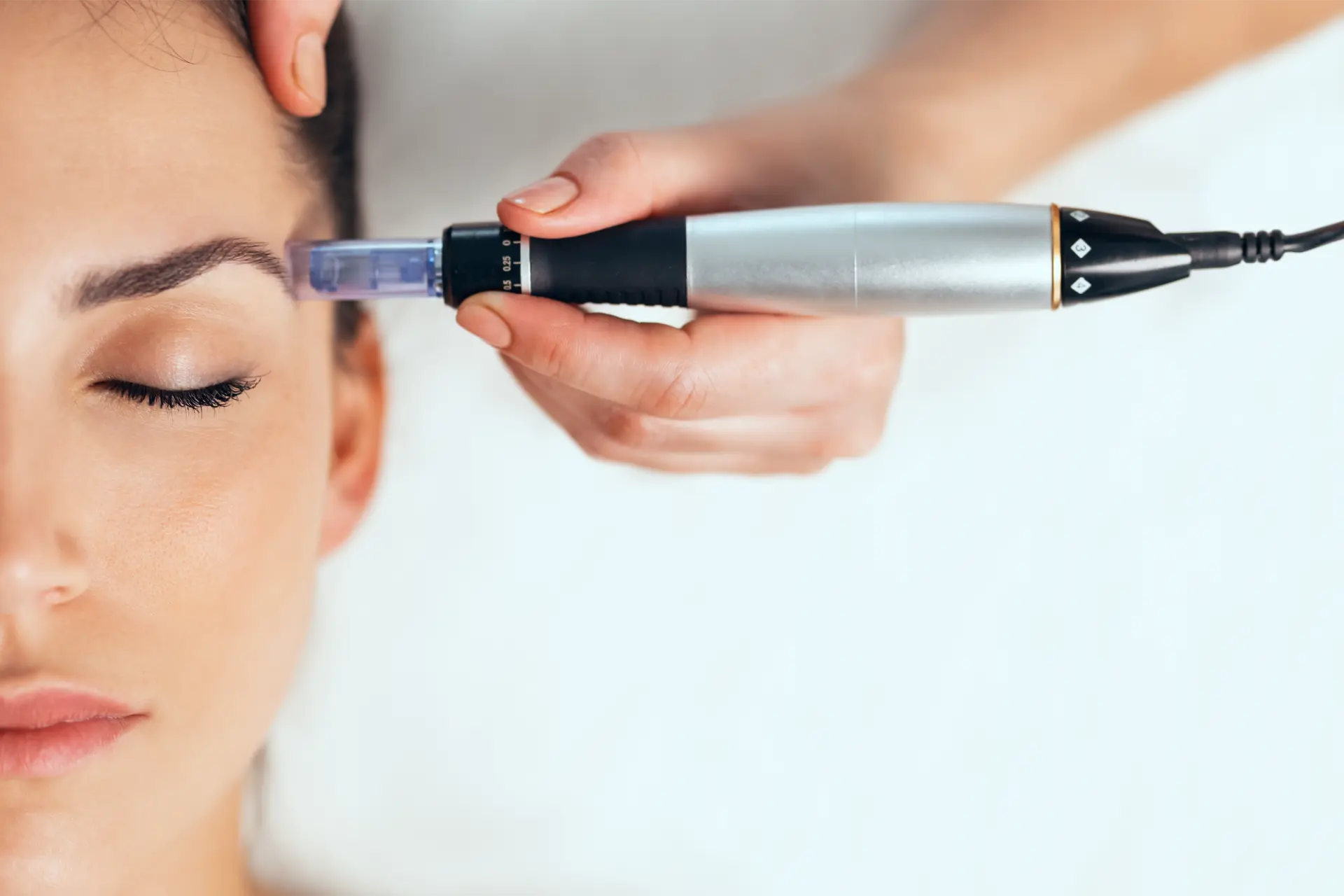 Skin Needling in Rockhampton