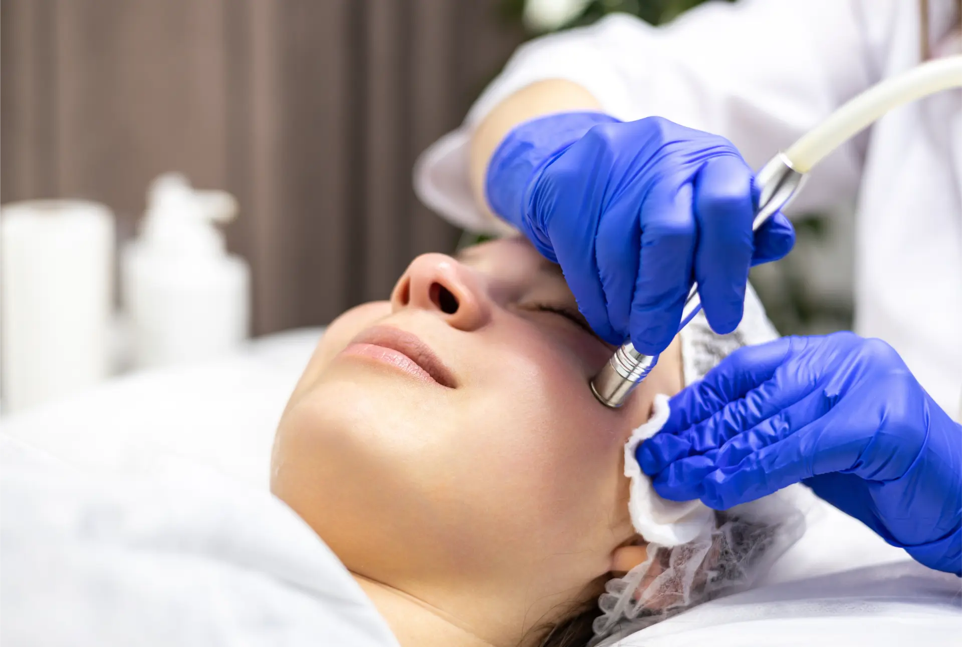 Skin Needling in Rockhampton