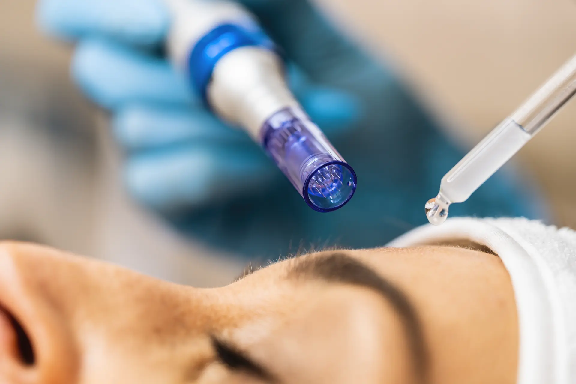 What Happens at a Skin Needling Consultation